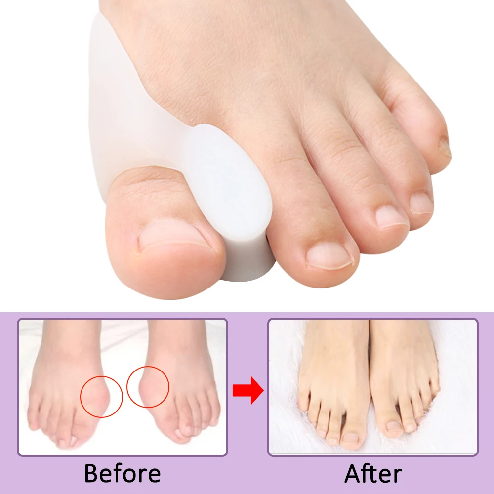 2/4/8Pcs Spacer Gel Big Bunion - Toe Separator Silicon 评论和价格