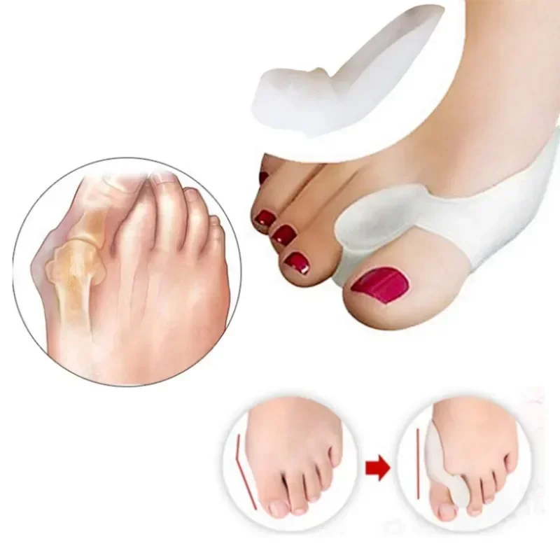 2PCS Silicone Gel Thumb Correc - Toe Separator Silicon 评论和价格