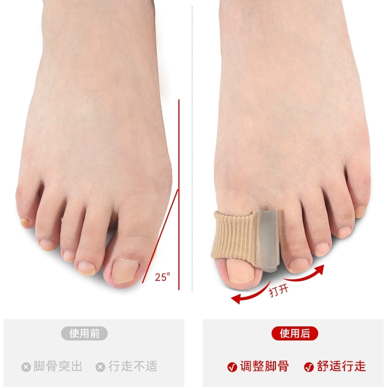 1/10Pcs Gel Toe Separators  Co - Toe Separator Silicon 评论和价格