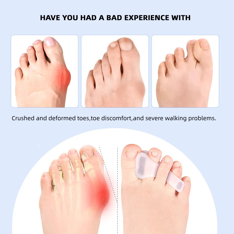 1/2/5Pairs Hallux Valgus Appli - Toe Separator Silicon 评论和价格